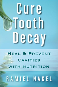 Cure Tooth Decay: Heal And Prevent Cavities With Nutrition