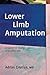 Lower Limb Amputation: A Guide to Living a Quality Life