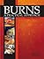 Burns: A Practical Approach to Immediate Treatment and Long Term Care