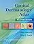 Genital Dermatology Atlas
