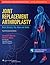 Joint Replacement Arthroplasty: Basic Science, Hip, Knee, and Ankle (Volume 2)