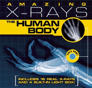 Amazing X-rays: The Human Body (Hardcover)