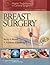 Breast Surgery by Kirby I. Bland