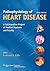 Pathophysiology of Heart Disease by Leonard S. Lilly Pathophysiology of Heart Disease by Leonard S. Lilly