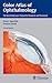 Color Atlas of Ophthalmology: The Quick-Reference Manual for Diagnosis and Treatment
