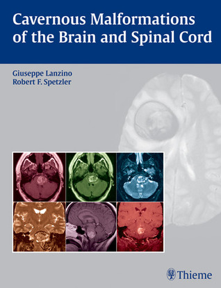 Cavernous Malformations of the Brain and Spinal Cord (Hardcover)