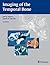 Imaging of the Temporal Bone