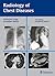 Radiology of Chest Diseases