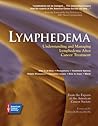 Lymphedema: Understanding and Managing Lymphedema After Cancer Treatment Lymphedema: Understanding and Managing Lymphedema After Cancer Treatment