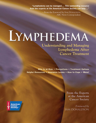 Lymphedema: Understanding and Managing Lymphedema After Cancer Treatment