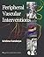 Peripheral Vascular Interventions