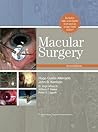 Macular Surgery Macular Surgery