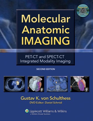 Molecular Anatomic Imaging Pet Ct And Spect Ct Integrated Modality Imaging By Gustav K Von Schulthess