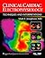 Clinical Cardiac Electrophysiology: Techniques and Interpretations