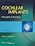 Cochlear Implants: Principles & Practice