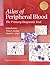 Atlas of Peripheral Blood: The Primary Diagnostic Tool