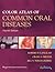 COLOR ATLAS OF COMMON ORAL ...