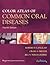 COLOR ATLAS OF COMMON ORAL DISEASES 4E by Robert P. Langlais