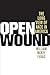 Open Wound: The Long View of Race in America