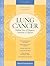 Lung Cancer: Making Sense of Diagnosis, Treatment, and Options