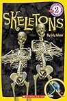 Skeletons by Lily Wood