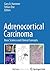Adrenocortical Carcinoma by Gary D. Hammer