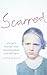 Scarred: How One Girl Trium...