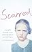 Scarred: How One Girl Triumphed Over Shocking Abuse and Self-Harm