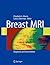 Breast MRI: Diagnosis and Intervention