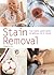 Stain Removal: Your Really ...