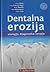 Dentalna erozija : etiologija, dijagnostika i terapija 