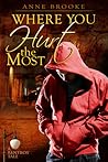 Where You Hurt the Most by Anne Brooke
