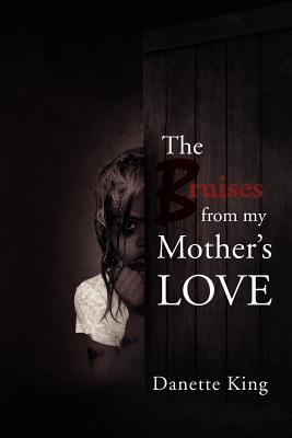 The Bruises from My Mother s Love