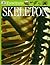 Skeleton (Eyewitness)