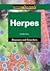 Herpes (Compact Research: Diseases & Disorders)