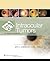 Intraocular Tumors by Jerry A. Shields Intraocular Tumors by Jerry A. Shields