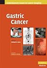 Gastric Cancer