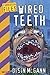 Wired Teeth (Forbidden Files)