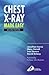 Chest X-Ray Made Easy