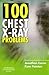100 Chest X-Ray Problems