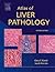 Atlas of Liver Pathology (Atlas of Surgical Pathology)