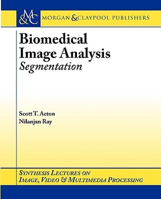Biomedical Image Analysis: Segmentation (Synthesis Lectures on Image, Video, & Multimedia Processing)