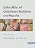 Color Atlas of Cutaneous Excisions and Repairs