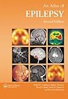 Atlas of Epilepsy