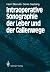 Intraoperative Sonographie der Leber und der Gallenwege by Henri Bismuth
