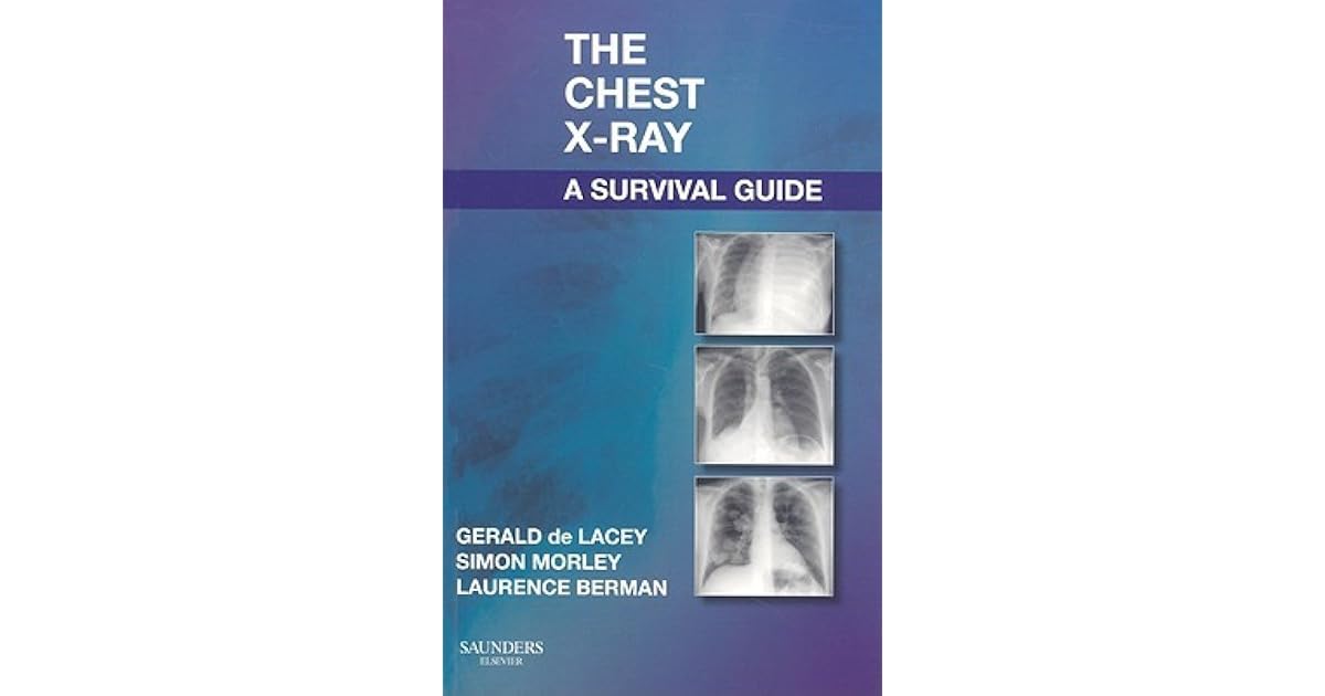 The Chest X-Ray: A Survival Guide by Gerald De Lacey