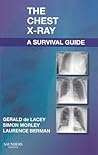 The Chest X-Ray: A Survival Guide The Chest X-Ray: A Survival Guide