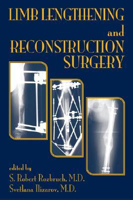 Limb Lengthening and Reconstruction Surgery (Hardcover)
