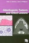 Odontogenic Tumours
