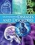 UXL Encyclopedia of Diseases and Disorders (5 Volume Set)